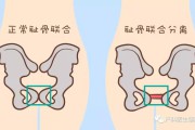 怀孕耻骨疼是什么位置(怀孕耻骨疼是什么位置图片)