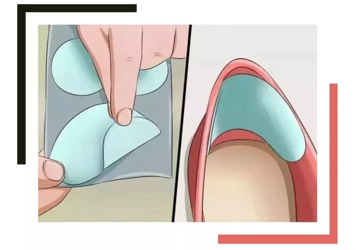 鞋后跟磨脚的小妙招